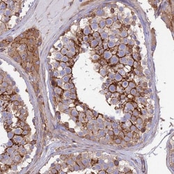 Septin-9 Antibody, Novus Biologicals 25 &mu;L, Unlabeled:Antibodies, Polyclonal